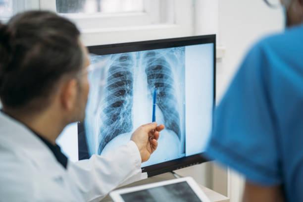 doctor reviewing xray